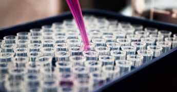 herpes zoster: el peor tipo de herpes