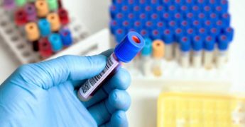 Diagnóstico de anemia, análisis de sangre