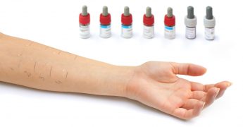 Métodos para la detección de alteraciones cutáneas