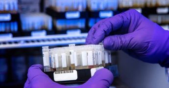 tipos de anticuerpos