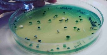 Qué es microbiología