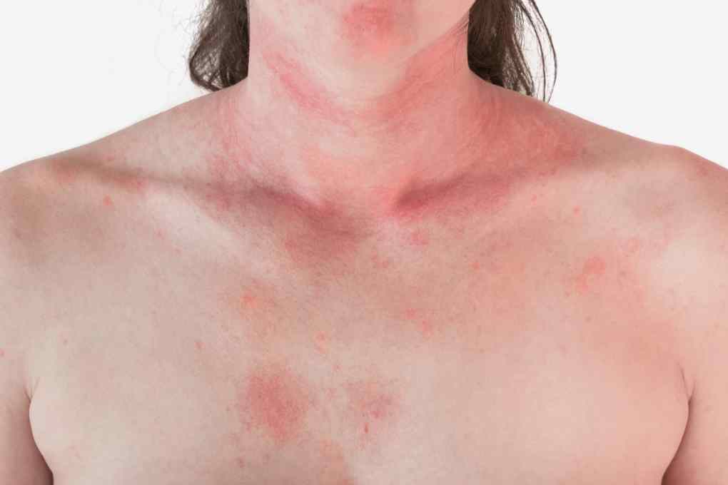 puntos rojos en la piel