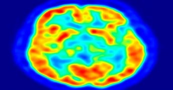 ¿se puede trabajar con epilepsia?